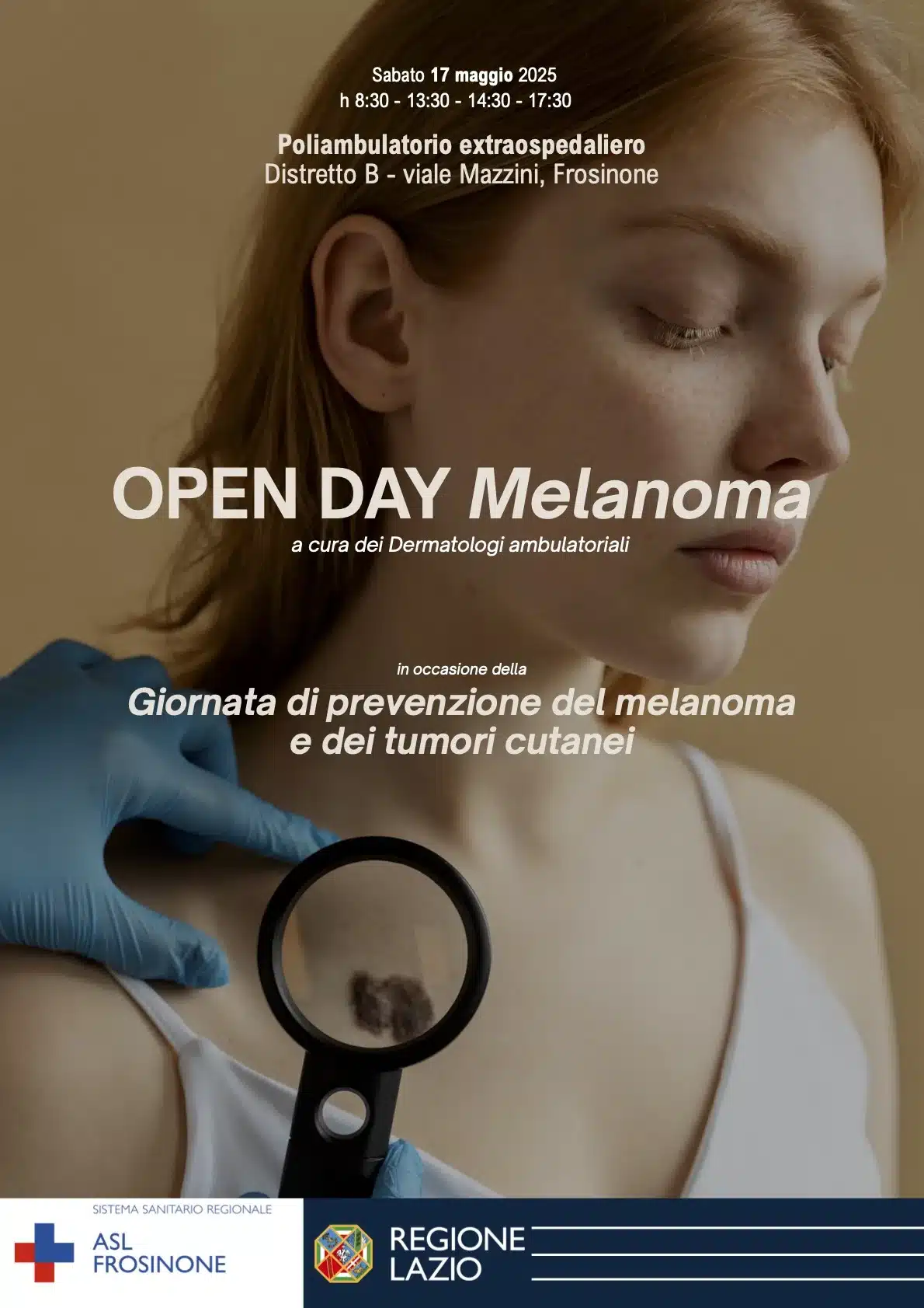 ASL Frosinone, a maggio Open Day di screening in occasione del mese della Prevenzione del Melanoma ASL Frosinone, a maggio Open Day di screening in occasione del mese della Prevenzione del Melanoma