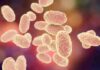 Una malattia respiratoria potenzialmente fatale, in Italia 5 casi dal 2000: cosโรจ la Difterite