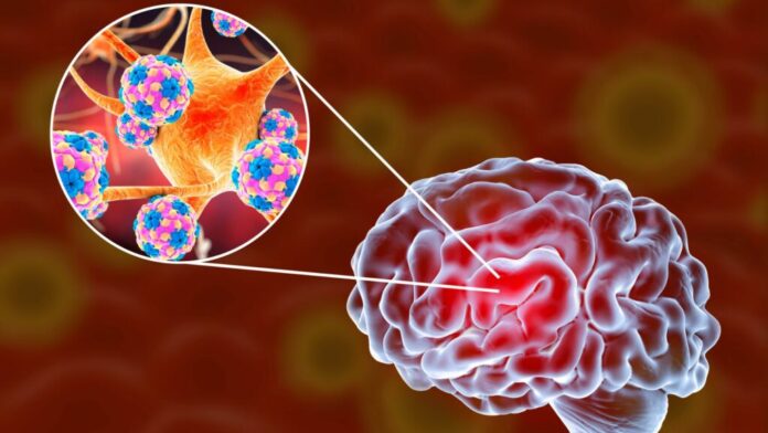 MENINGITE-1024x576